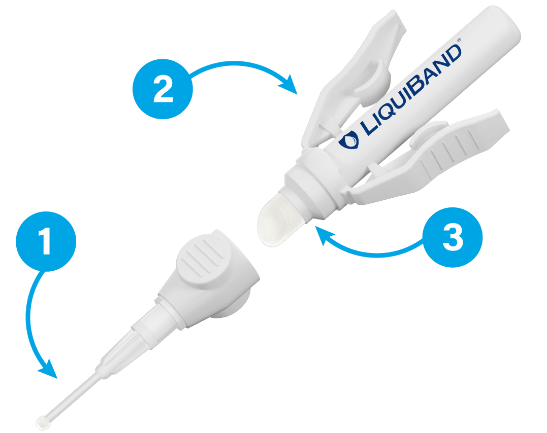 LiquiBand® Surgical S Box of 6