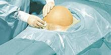 Drape General  Surgical Non Adhesive sterile 75x90 box 40